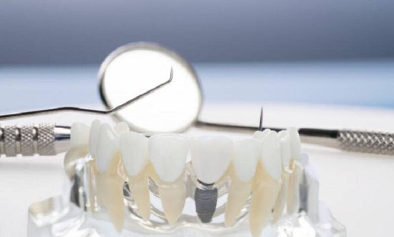 دندانسازی تجربی