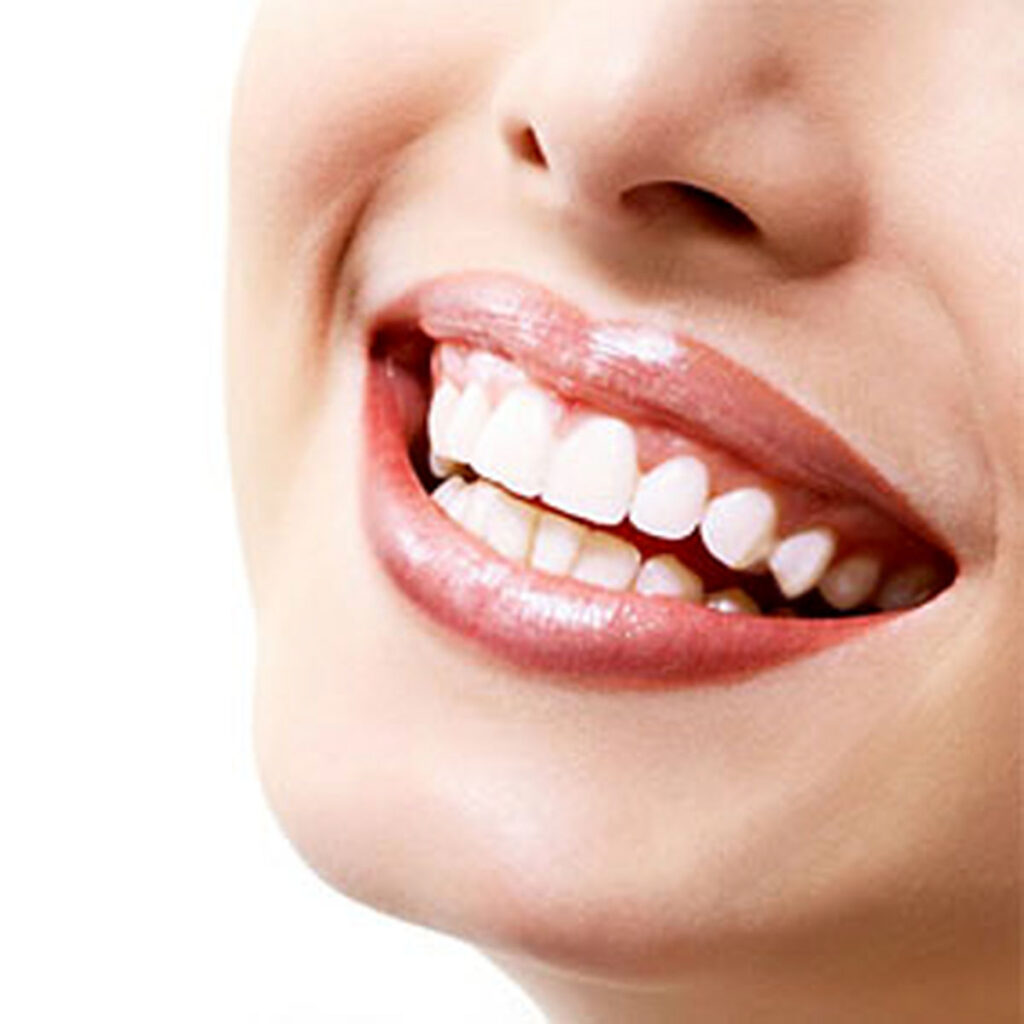 روش‌های خانگی برای جرم‌گیری دندان