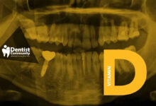 تأثیر کمبود ویتامین D بر پوسیدگی دندان‌ها و راهکارهای پیشگیری