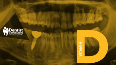 تأثیر کمبود ویتامین D بر پوسیدگی دندانها و راهکارهای پیشگیری