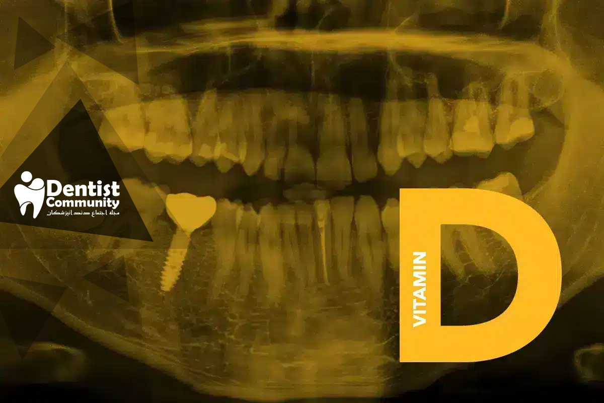 تأثیر کمبود ویتامین D بر پوسیدگی دندان‌ها و راهکارهای پیشگیری