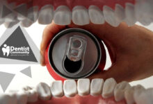 بررسی تخصصی تاثیر نوشابه های گازدار بر سلامت دهان و دندان