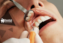 ارتباط بیماری لثه و افزایش خطر اختلال نعوظ