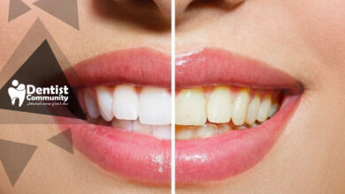 بهترین زمان مسواک زدن بعد از قهوه یا چای برای جلوگیری از لکه دندان و زردی مینای دندان