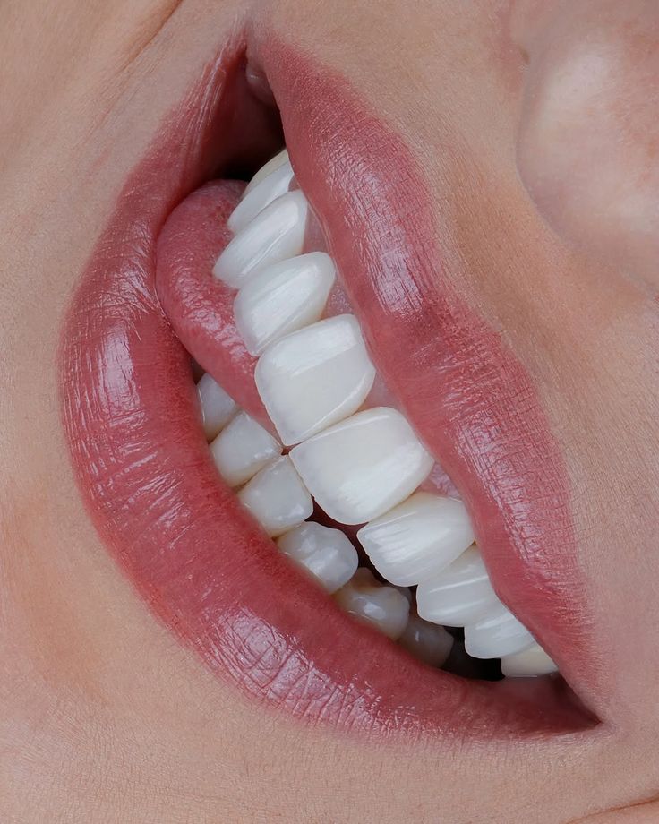 ونیر کامپوزیت