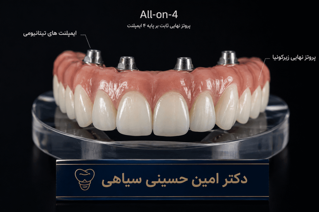 مراحل جراحی All-on-4 در کلینیک دکتر امین حسینی سیاهی