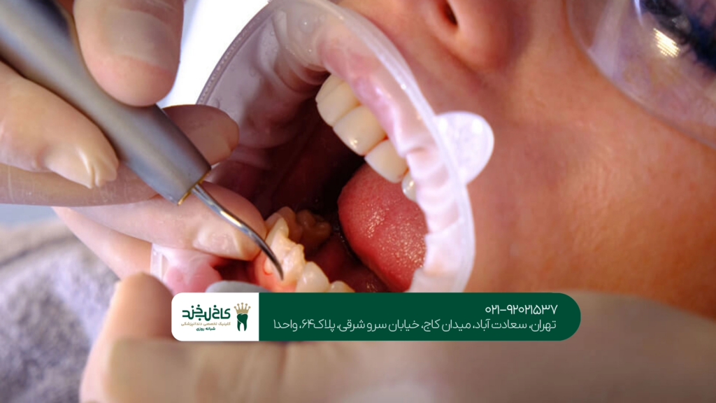 دندانپزشکی تهران