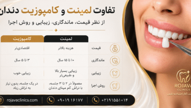 مقایسه لمینت و کامپوزیت دندان؛ تفاوتها، مزایا و انتخاب بهترین روش