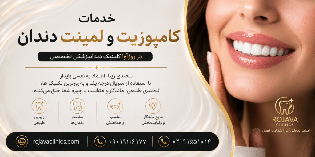لمینت یا کامپوزیت دندان؟ مقایسه کامل تفاوتها، مزایا، هزینه و انتخاب بهترین روش زیبایی لبخند